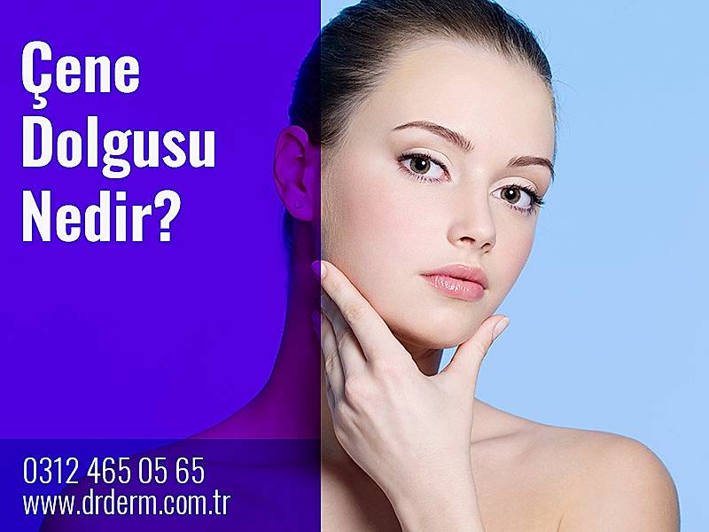 Çene Dolgusu Nedir?